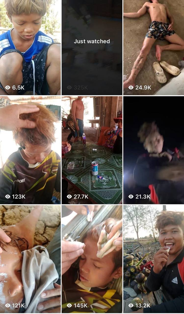 关于恶意虐童导致儿童失明的预警