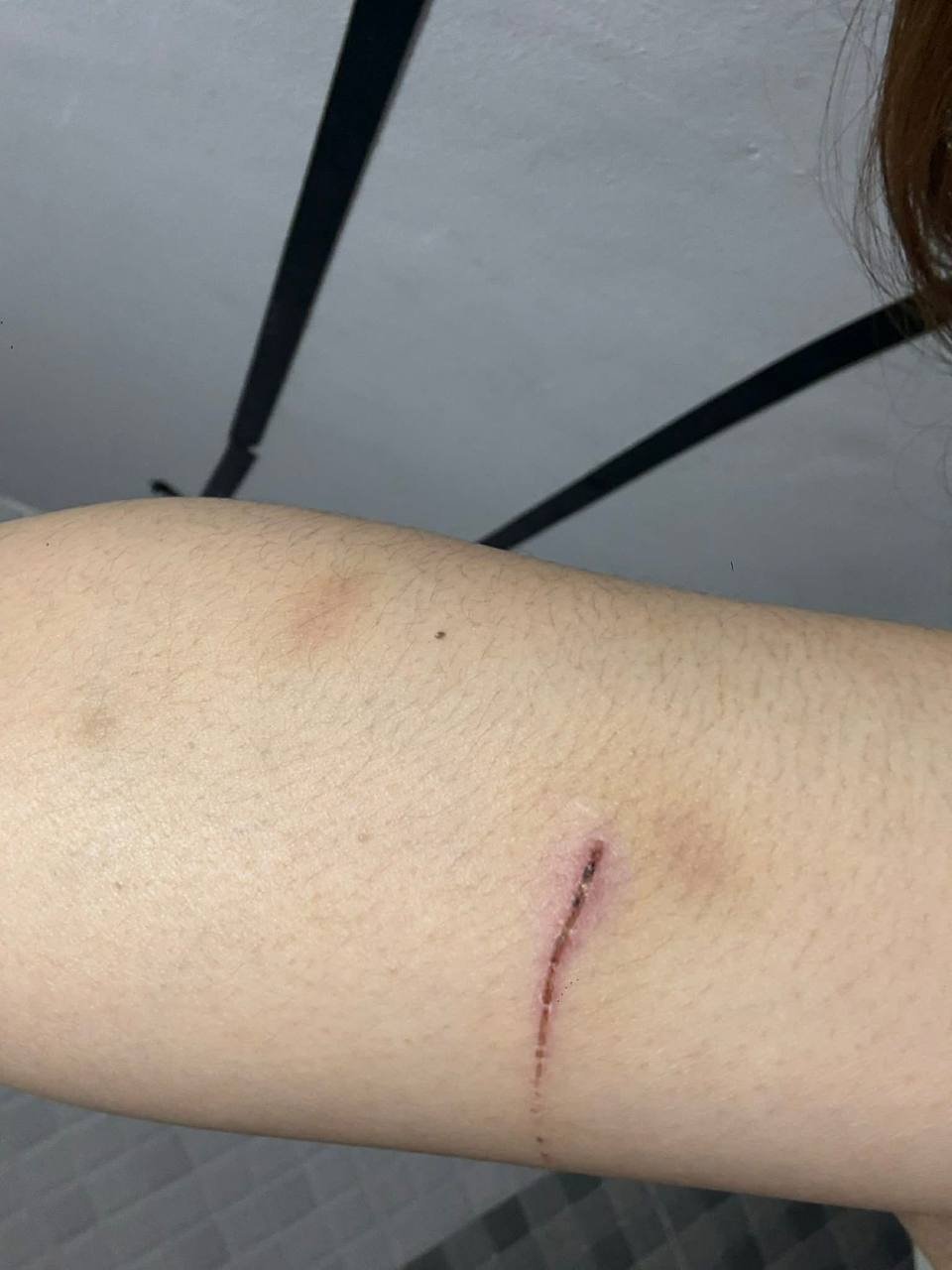 女子求助:遭警察丈夫家暴、非法拘禁及死亡威胁