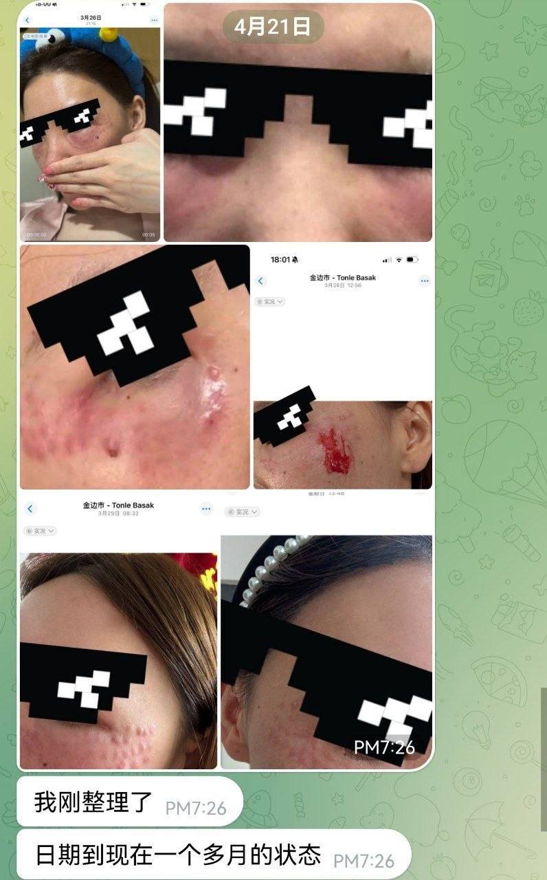 警惕柬埔寨非法医美:郭红涉嫌无证行医及吸毒毁容