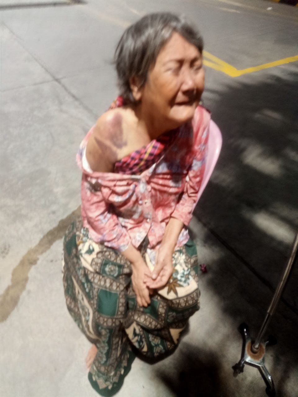 直播：女儿殴打年迈母亲致全身受伤的暴力案件