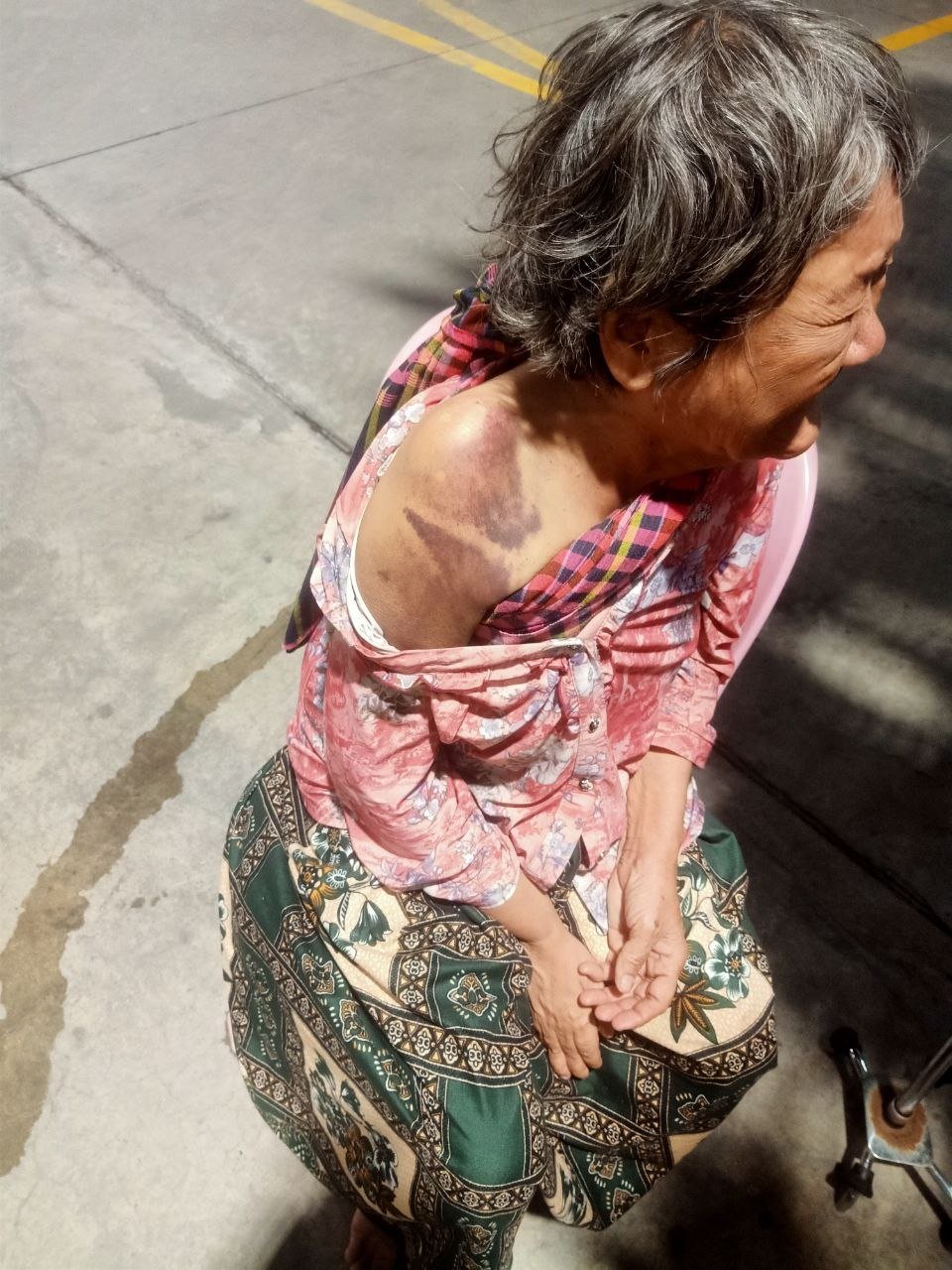 直播：女儿殴打年迈母亲致全身受伤的暴力案件