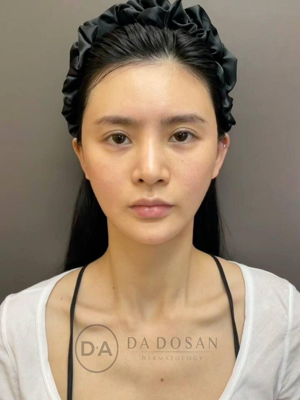 医美/美容咨询服务