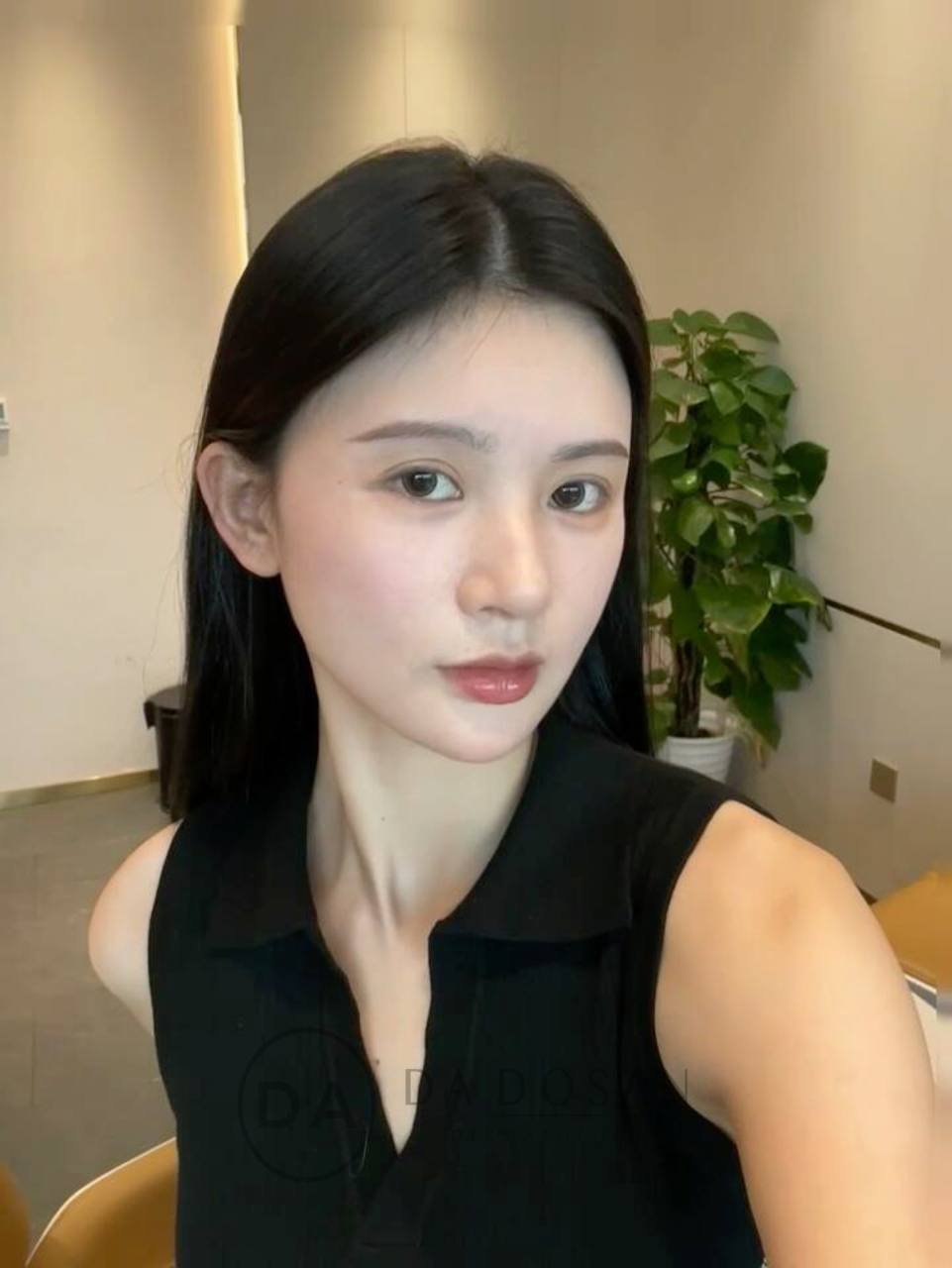 医美/美容咨询服务