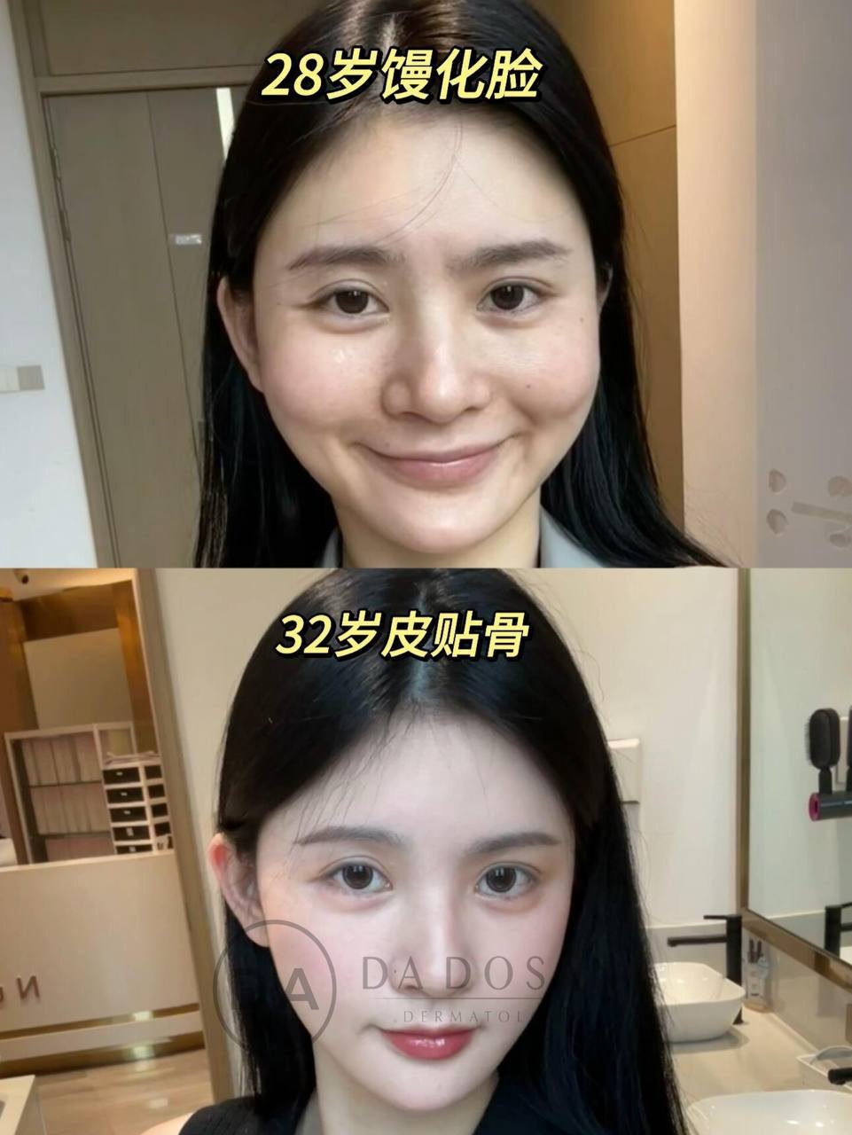 医美/美容咨询服务