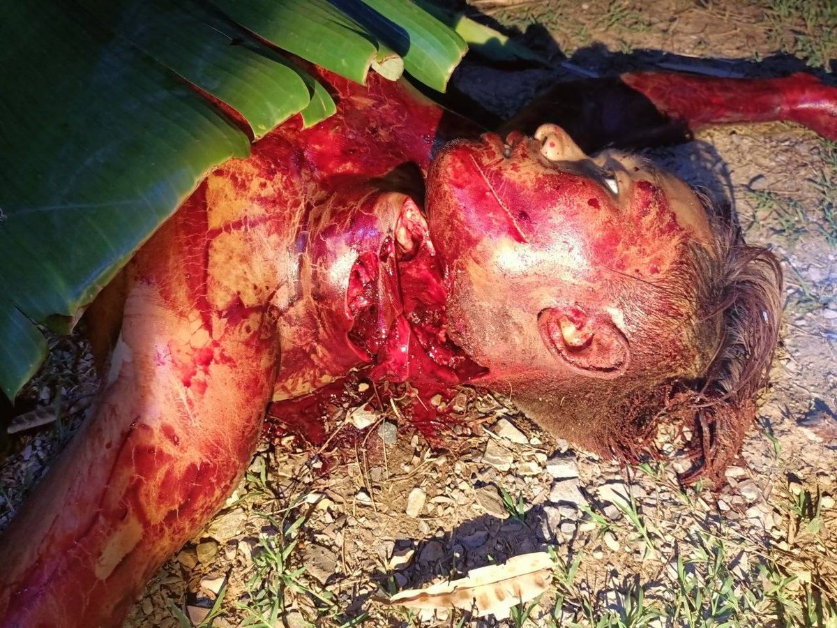 班迭棉吉省发生酒后持刀杀人案 嫌疑人已被警方逮捕
