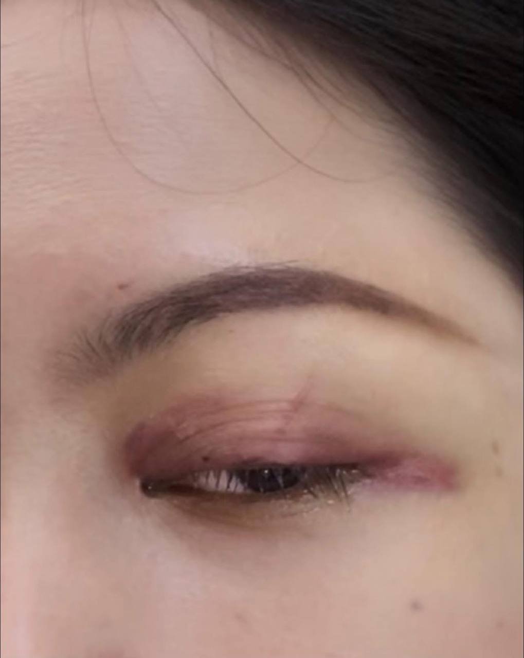 瓶装棕榈糖水冰箱内炸裂 导致一名女性眼部重伤