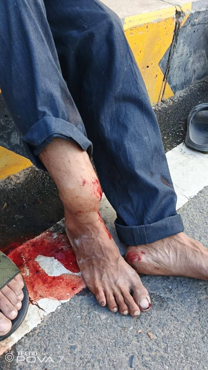 金边菩森芷区发生肇事逃逸 汽车撞倒摩托车致人重伤