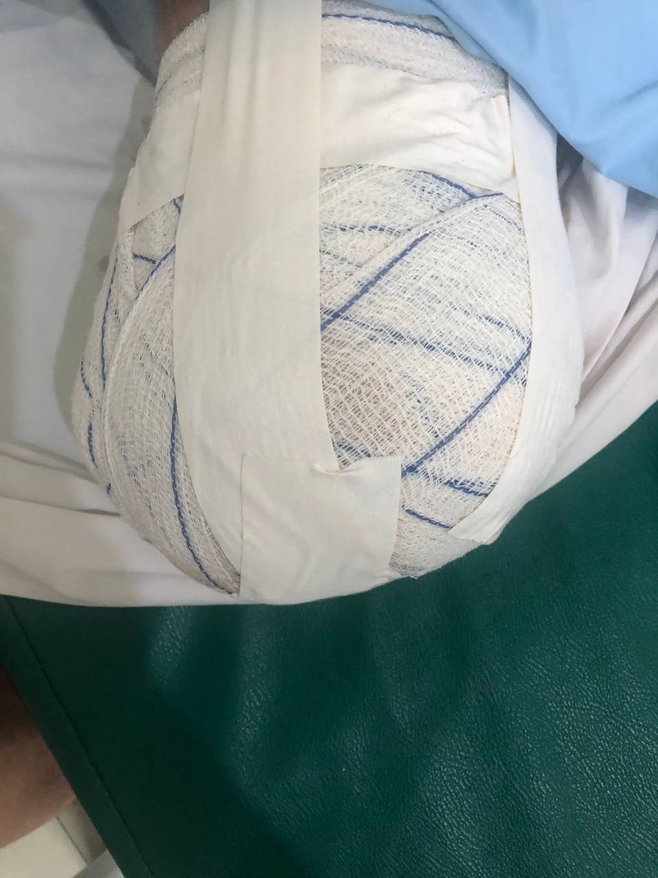 波贝维加斯园区受害者遭遗弃 医药费欠款面临报警