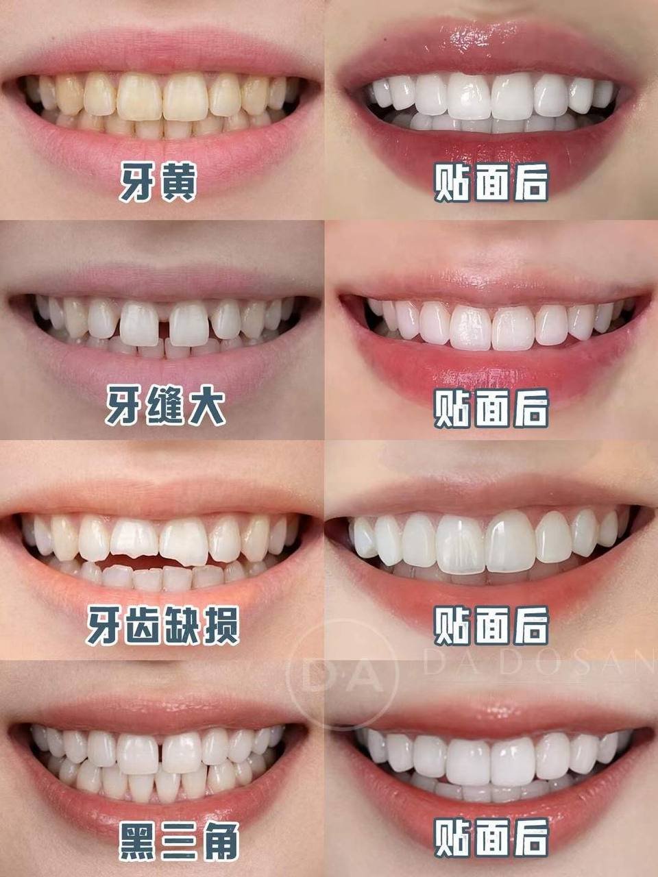 东南亚连锁医美机构金边店 皮肤管理及针剂项目优惠