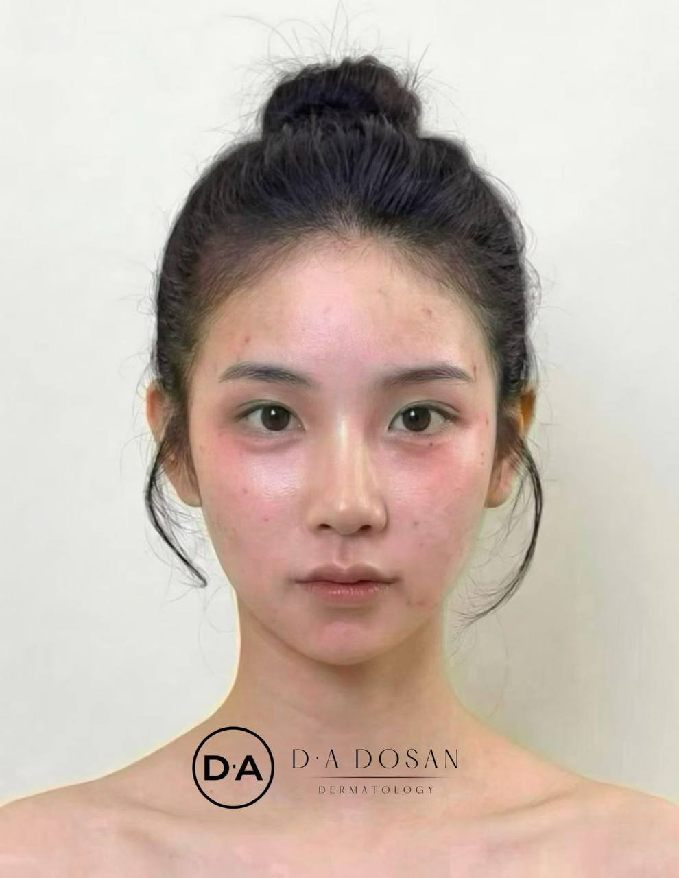 金边医美韧带提升与玻尿酸注射服务 接受低预算定制