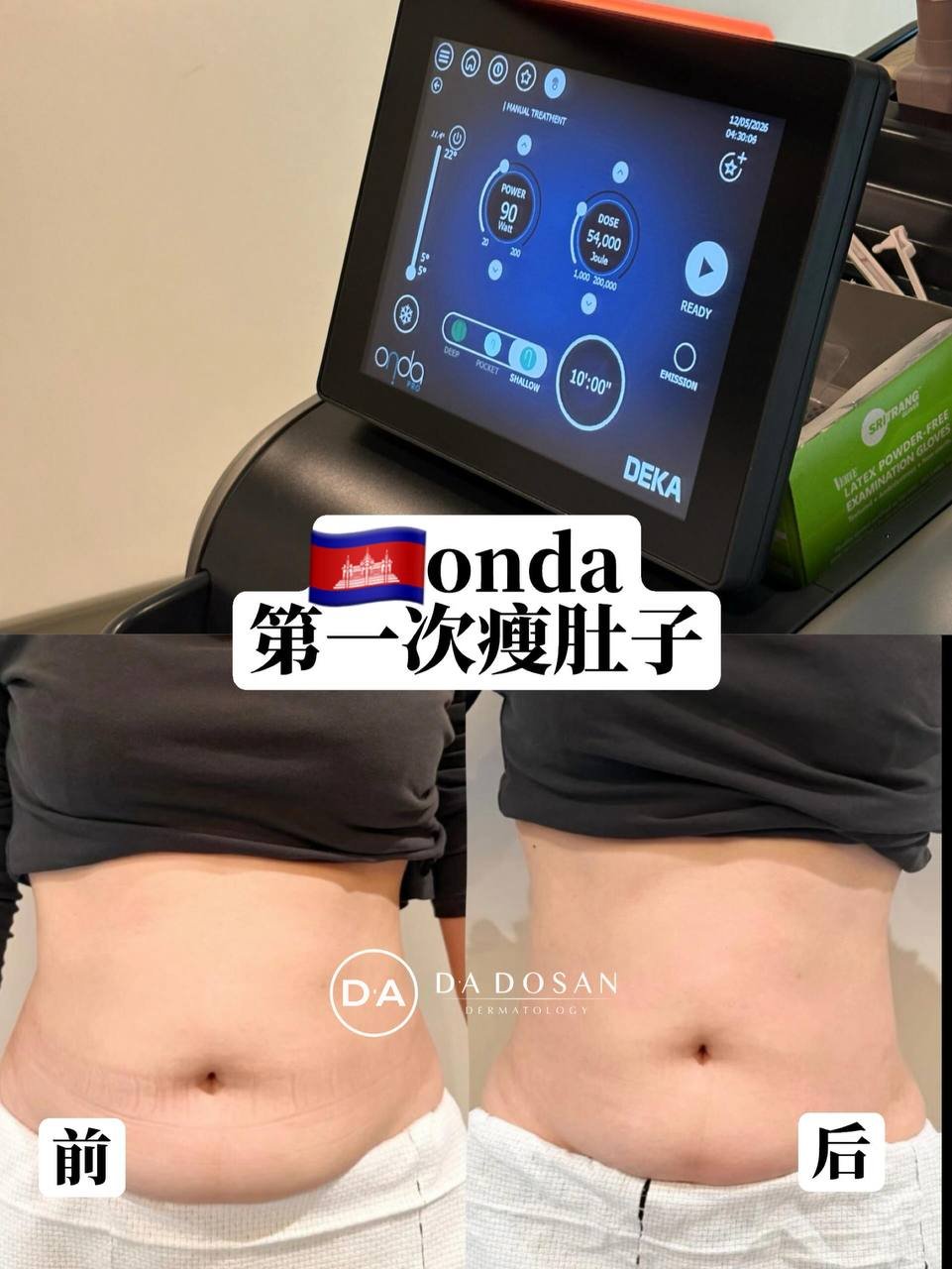 DA DOSAN韩国医美五月优惠 398美元全项目预约
