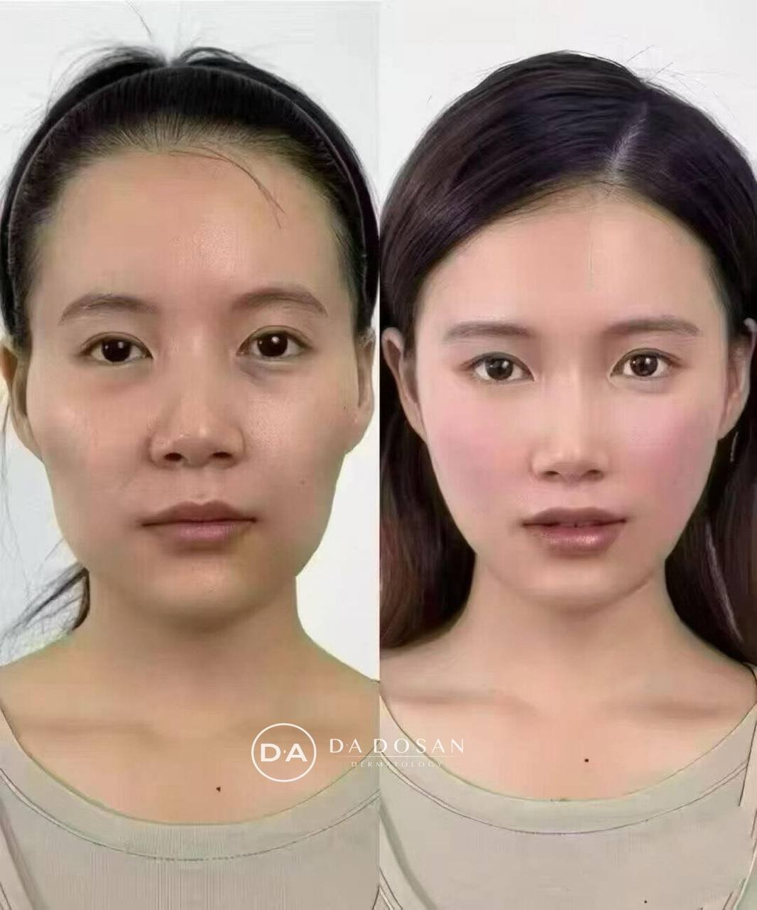 DA DOSAN韩国皮肤科年中大促 全项目一站式医美服务