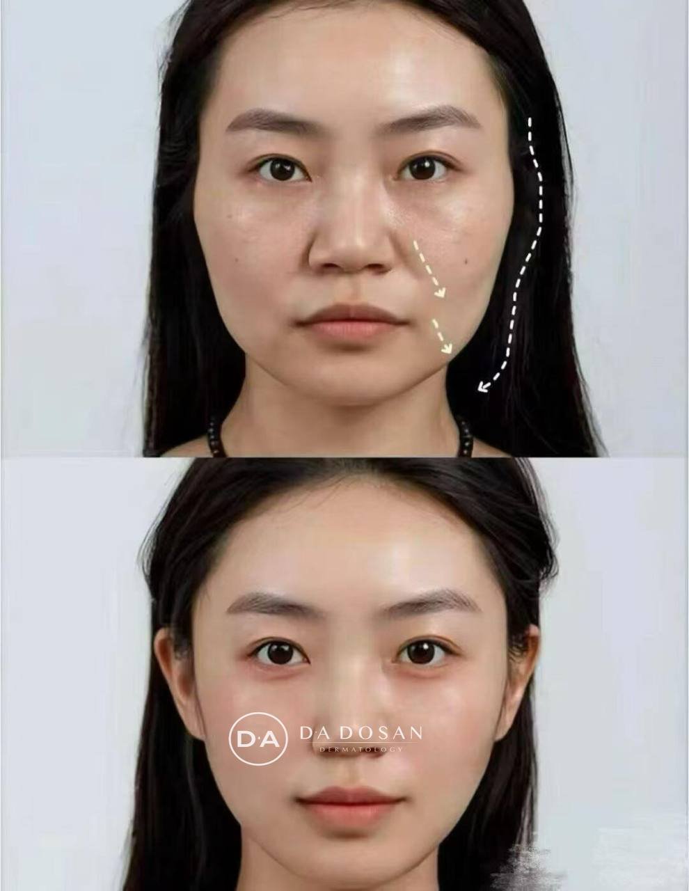 DA DOSAN韩国皮肤科年中大促 全项目一站式医美服务