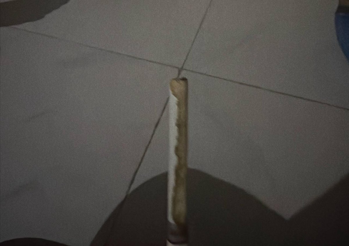 金边3号安置点关押环境恶劣 皮肤病频发且缺水