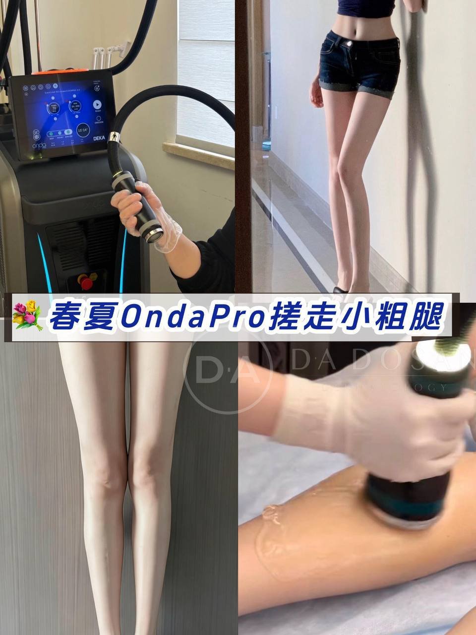 金边西港Onda pro局部减脂服务 懒人塑形