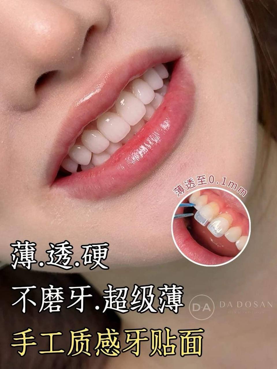 金边西港牙齿美白服务 提升笑容质感 预约咨询