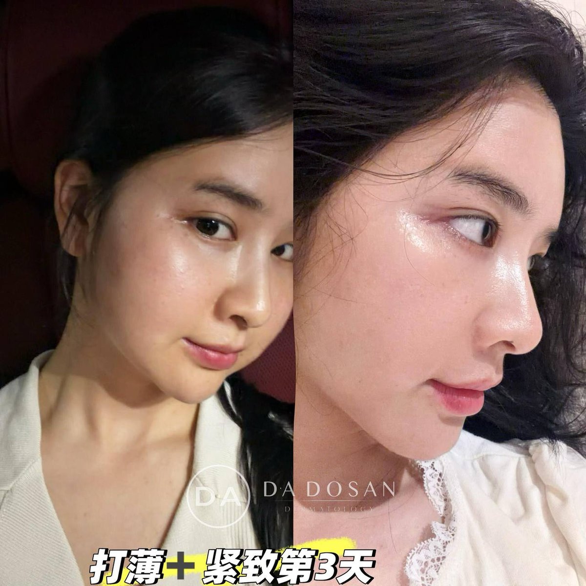 轻薄脸医美服务推广 效果立竿见影支持多国咨询