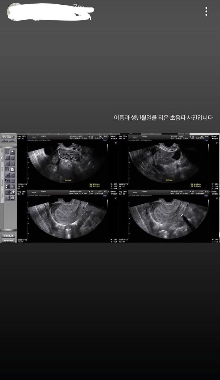 韩星洪敏基卷入丑闻 社交媒体流传相关视频照片