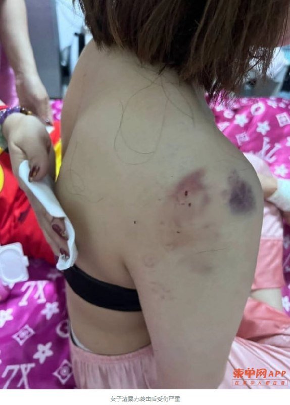 西港公寓发生暴力伤人事件 警方正追捕涉案中国男子