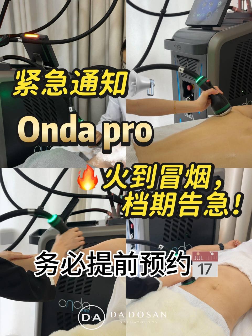 金边OndaPro美容项目火热 针对局部塑形