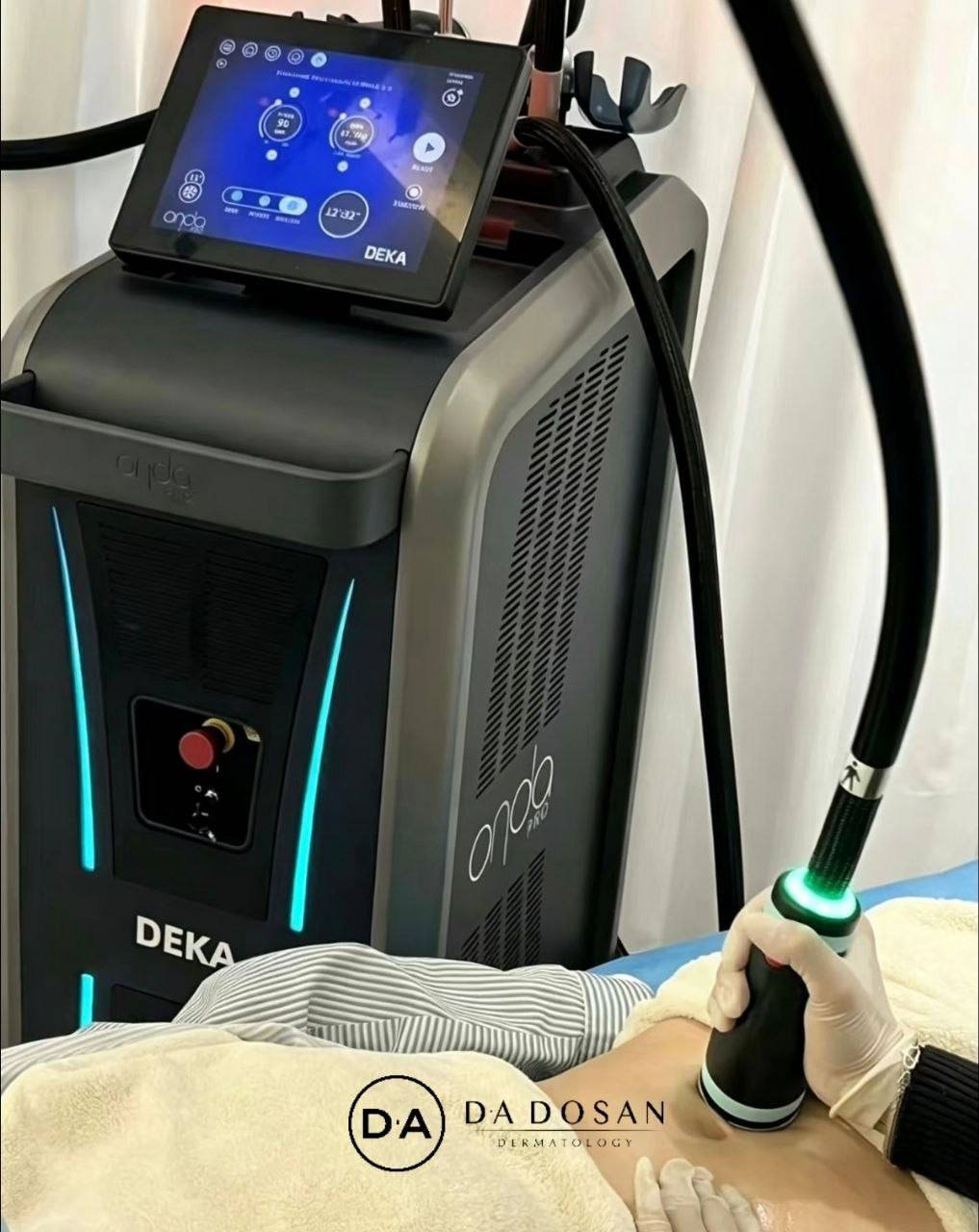 Onda pro非侵入式塑形服务 改善下颌线及腰腹赘肉