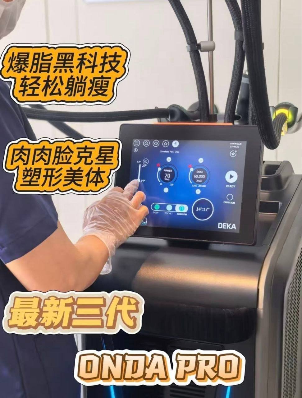 Onda pro非侵入式塑形服务 改善下颌线及腰腹赘肉
