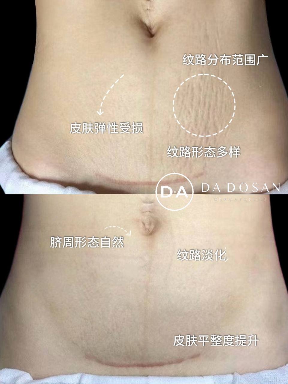 美容机构提供妊娠纹淡化服务 覆盖多国连锁