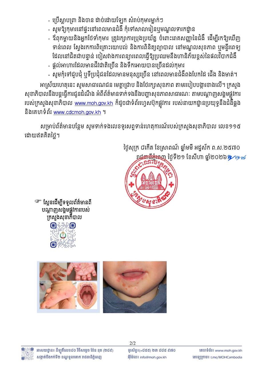 柬埔寨卫生部发布手足口病预防预警