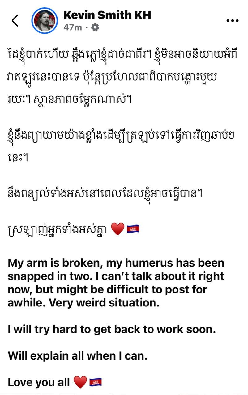 知名博主Kevin Smith遭遇严重骨折事故 暂停更新