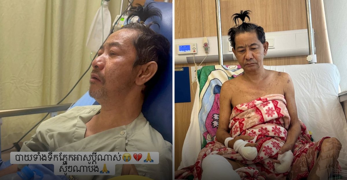 柬埔寨艺人纳塔克西糖尿病恶化截肢 家属辟谣传闻