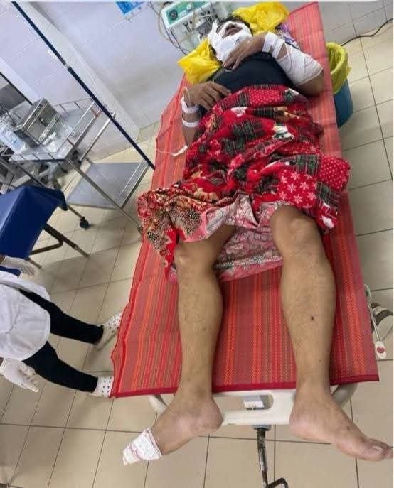 维拉文塔客车撞伤摩托车手 赔偿$1500受害者在越治疗
