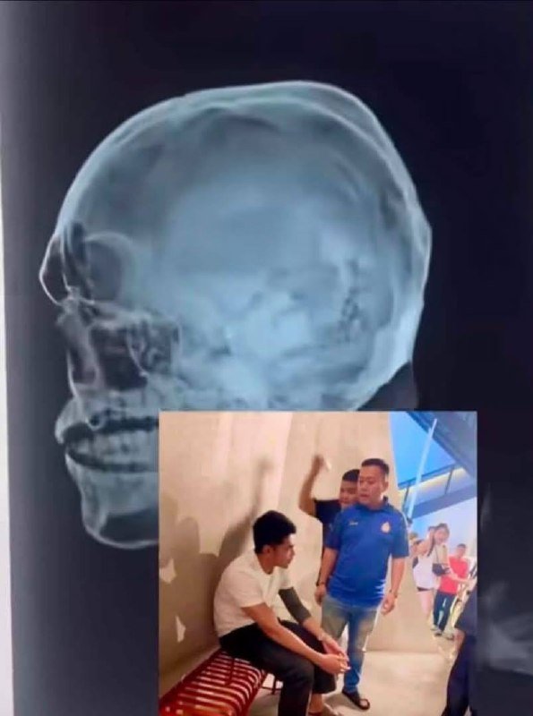 金边发生暴力伤人事件 受害者颅骨受损