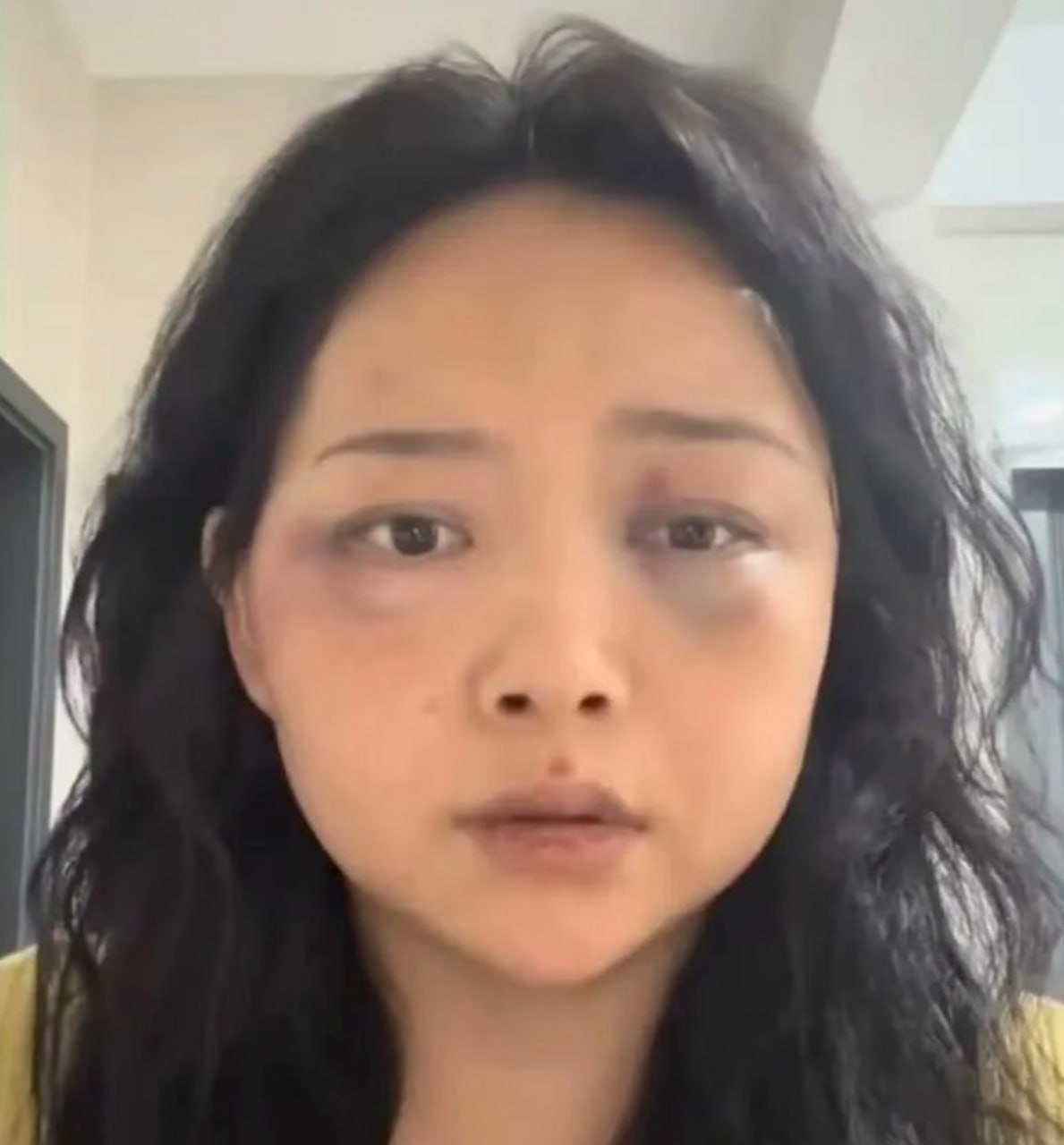 中国女子赴菲奔现遭殴打 已连夜回国报警