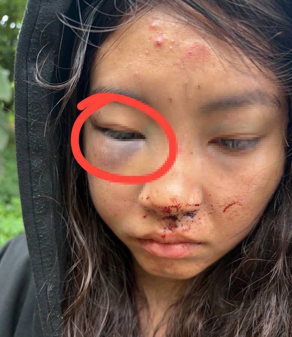 紧急求助