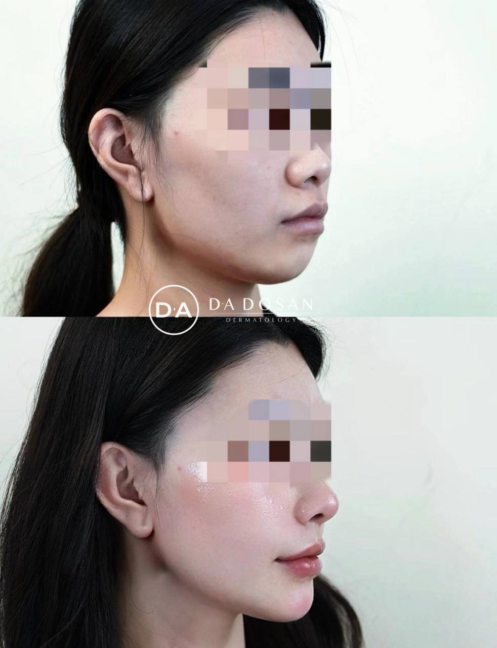 DA DOSAN韩国皮肤科连锁 覆盖医美抗衰及大健康项目