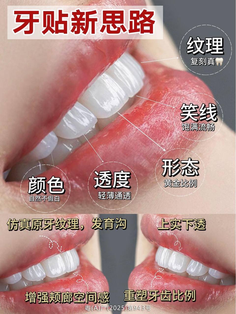 金边牙齿美学定制服务 16颗美牙$6800