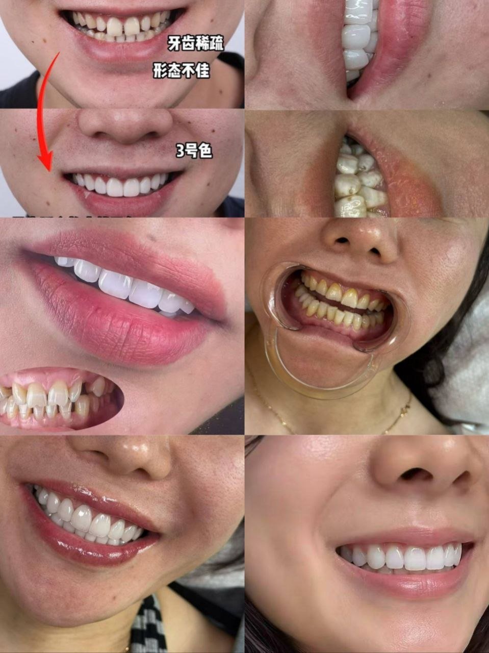 金边专业口腔诊所提供全瓷美牙及隐形矫正