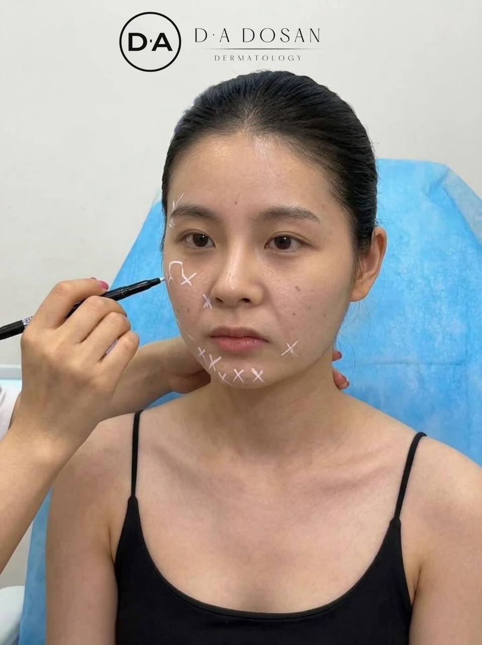皮贴骨抗衰新方案 紧致提升服务