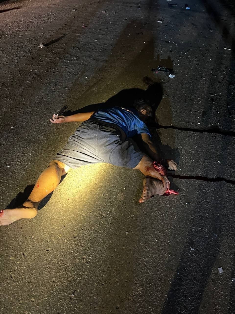 波贝发生严重交通事故致一人死亡