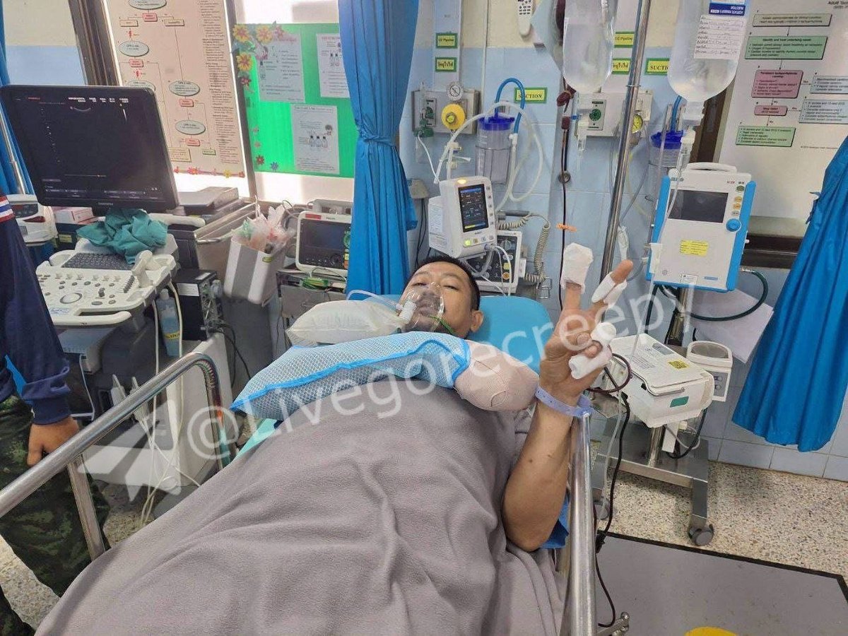 泰籍士兵在边境触雷受伤 目前正在医院接受治疗