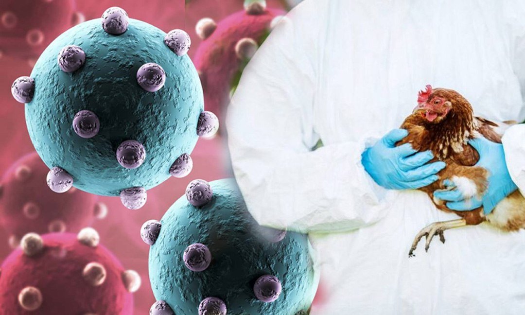 奥多棉芷省男子感染H5N1禽流感