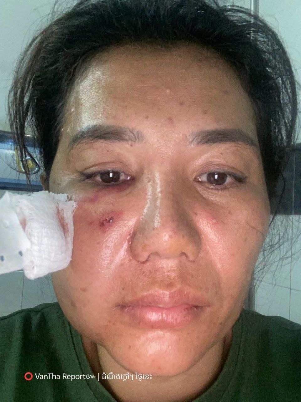 磅湛省发生枪击伤人事件 警方正全力追捕嫌犯