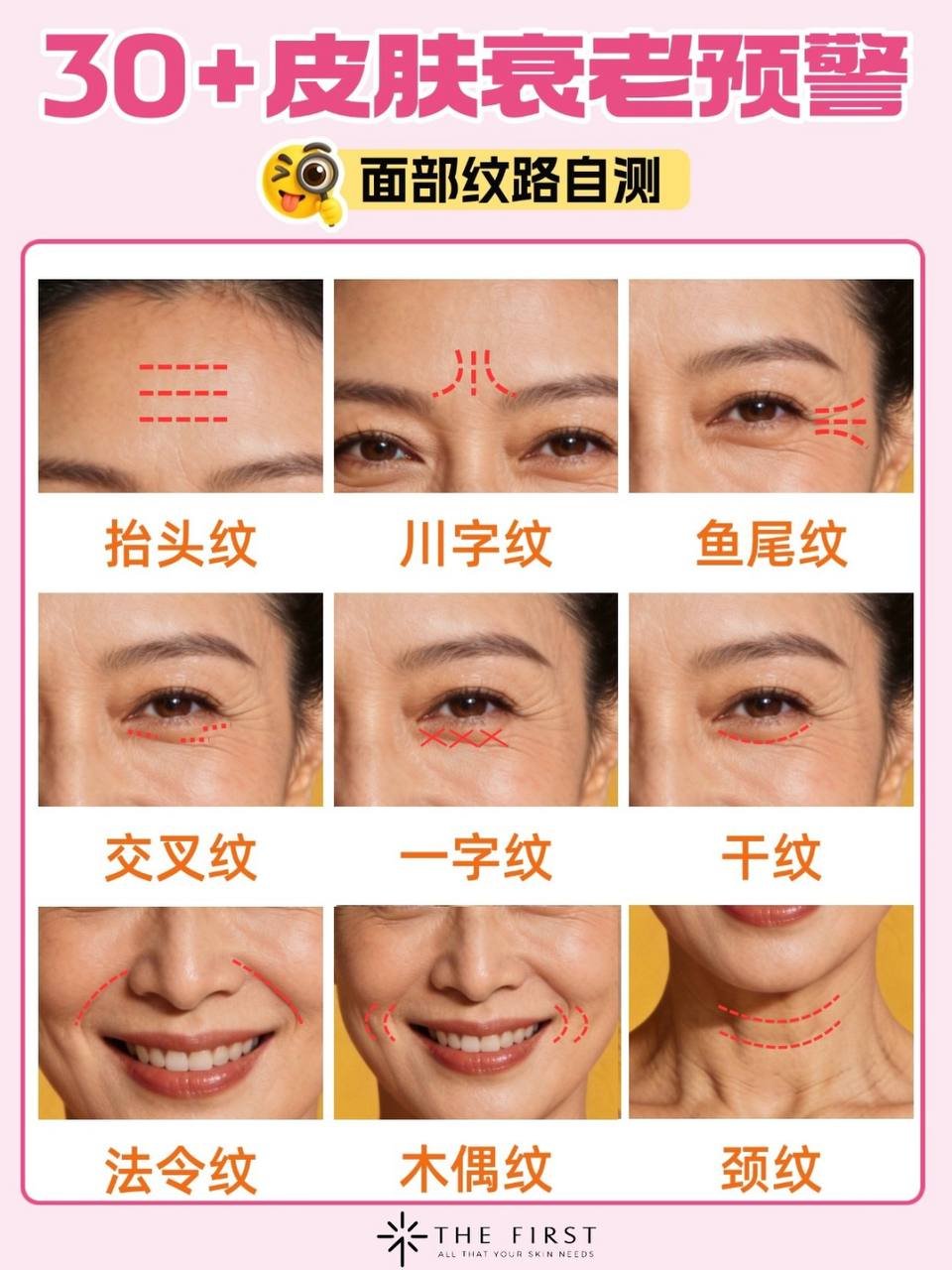 柬埔寨提供专业祛皱管理服务 24小时在线咨询