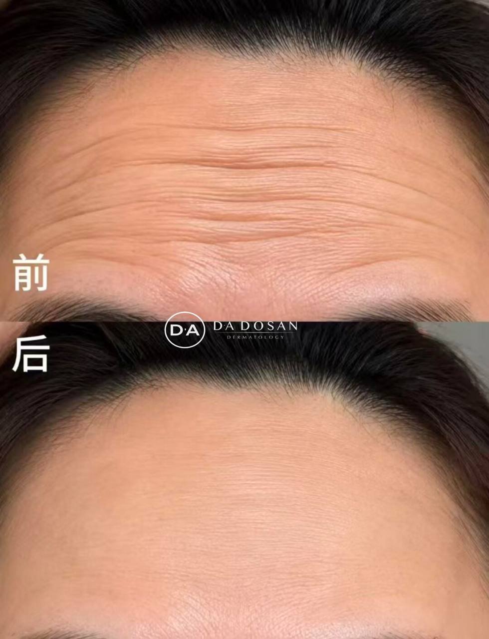 专业医美除皱保养服务 提升面部年轻化