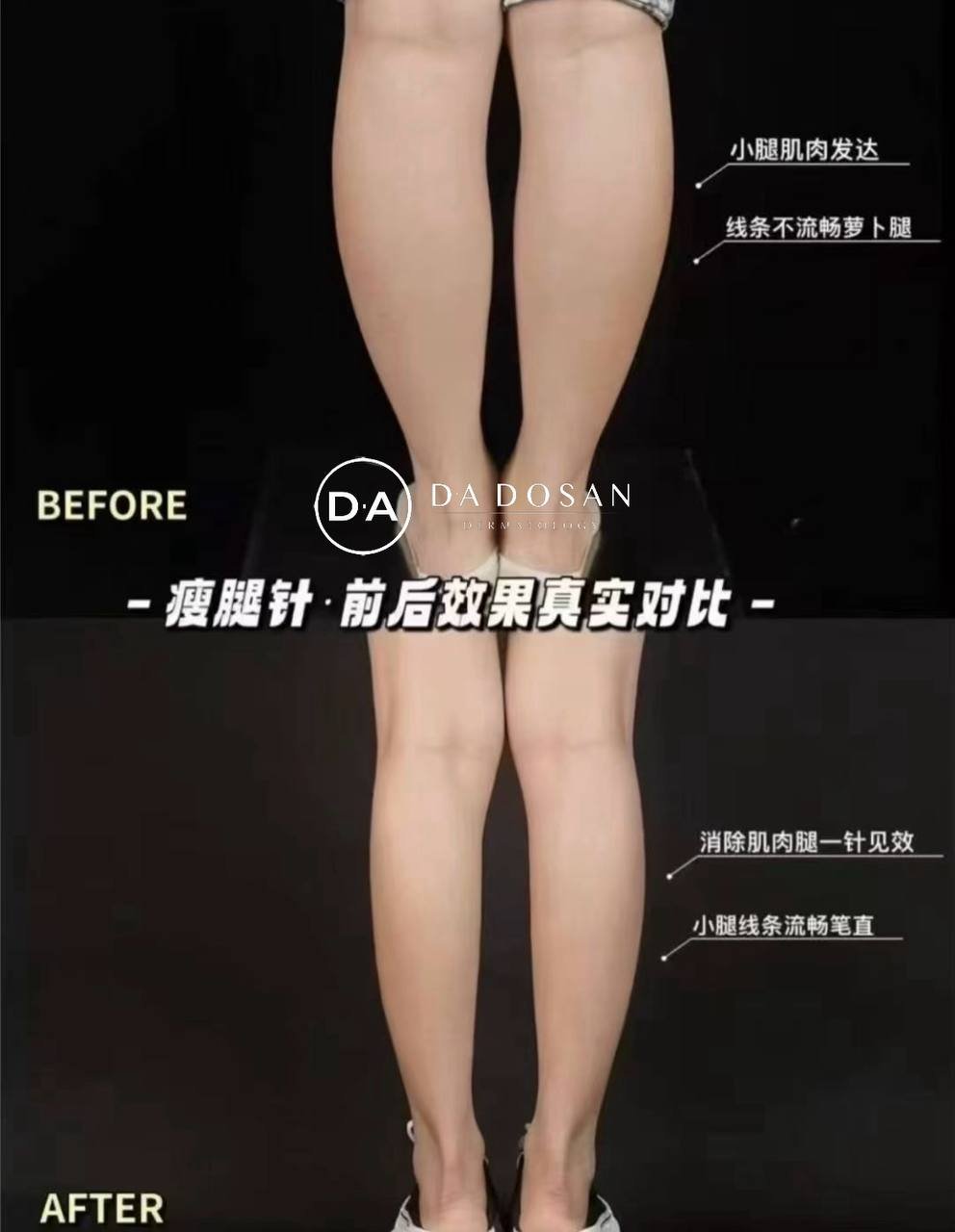 东南亚连锁医美机构提供皮肤管理及针剂美容