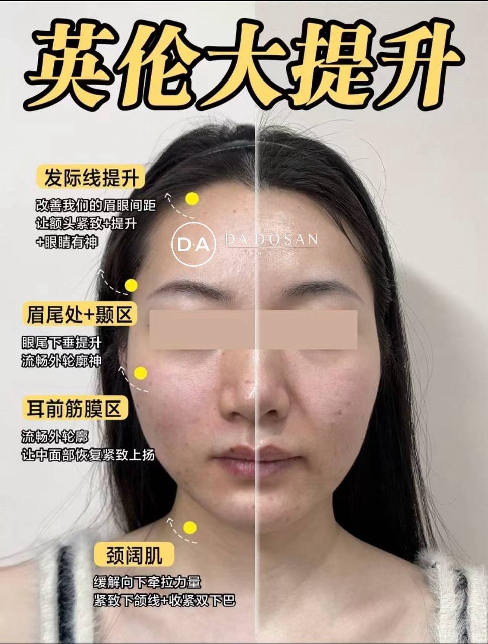柬埔寨医美服务瘦脸针优惠 $399起多国连锁