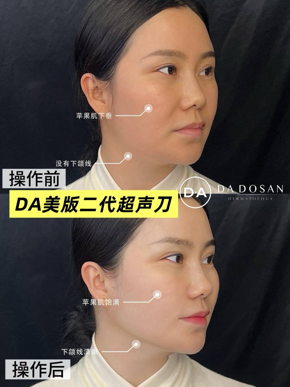 美容光电卡免费体验3年 覆盖金边及多国分店