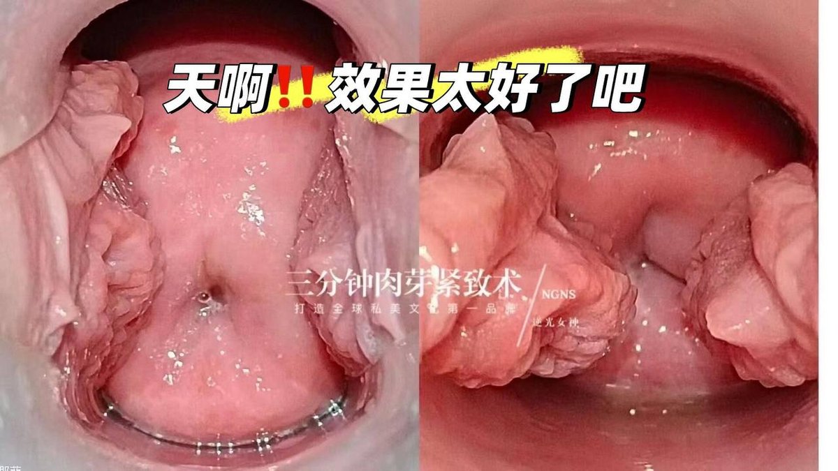 东南亚连锁医美机构提供皮肤管理及整形服务