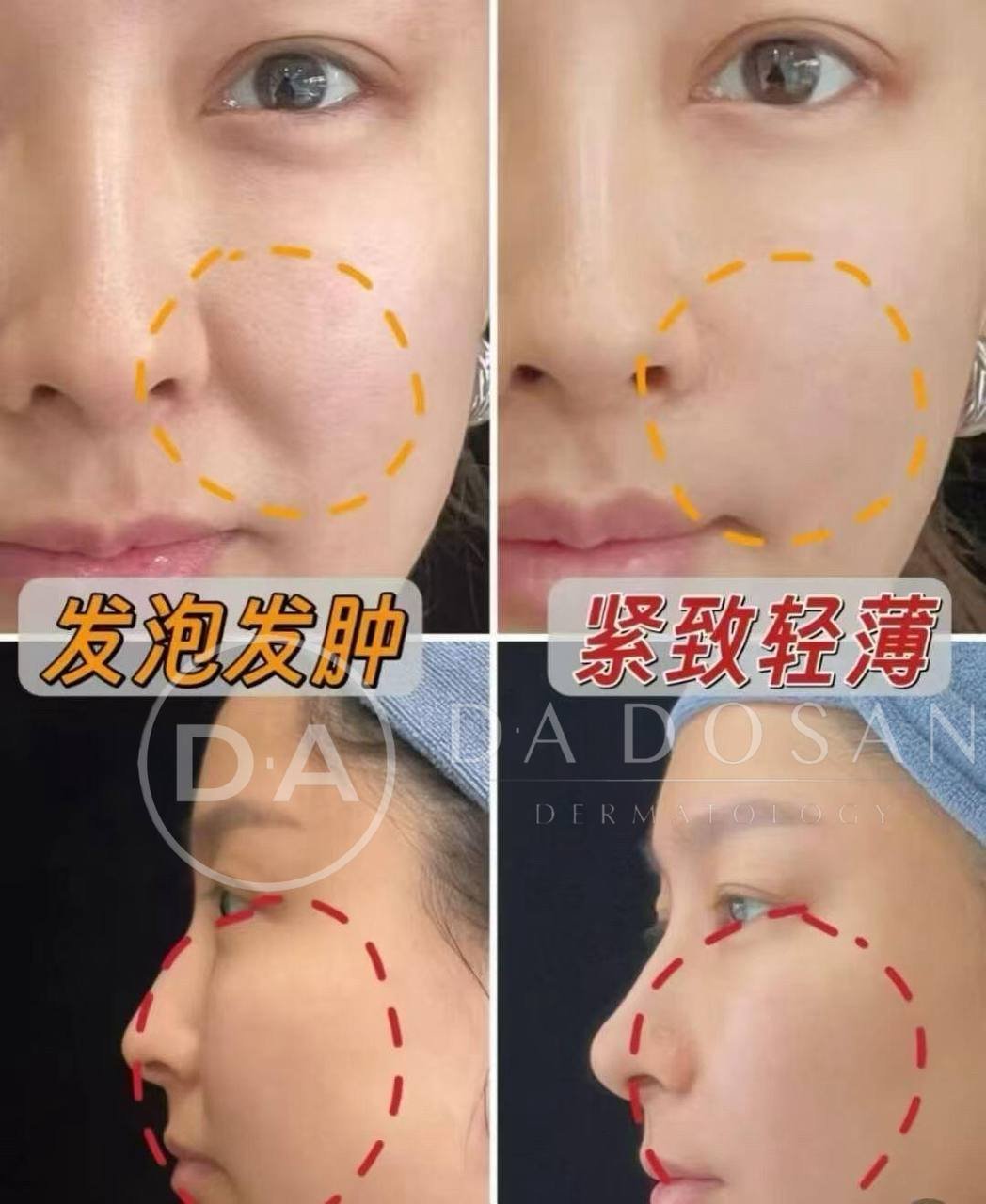轻薄紧致美容服务 柬埔寨等多国均有分店