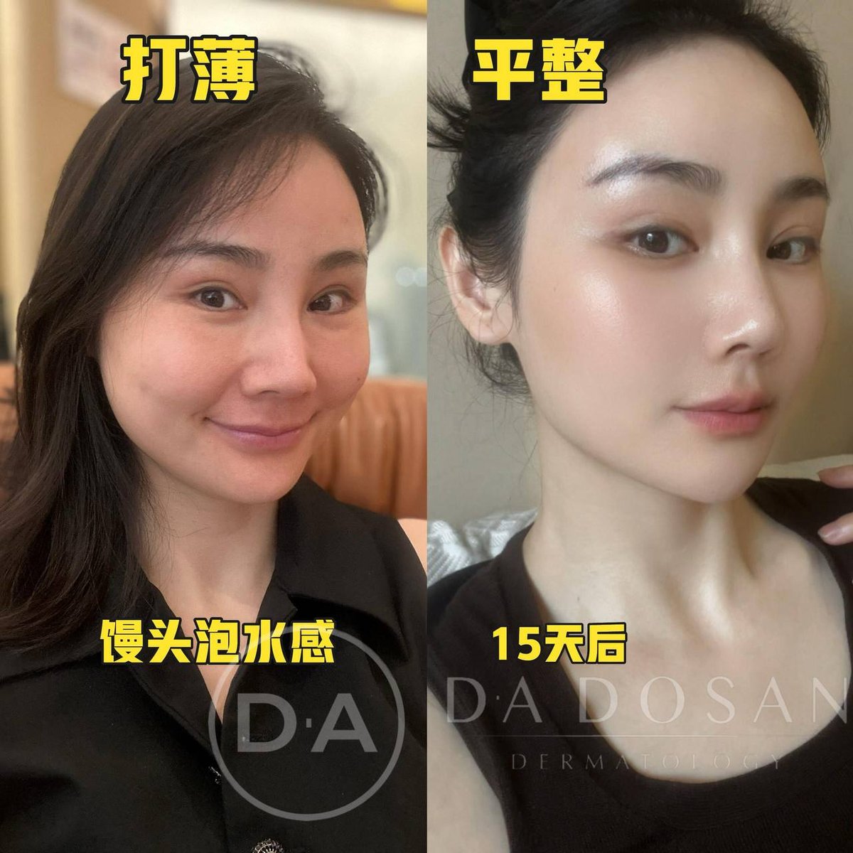 轻薄紧致美容服务 柬埔寨等多国均有分店